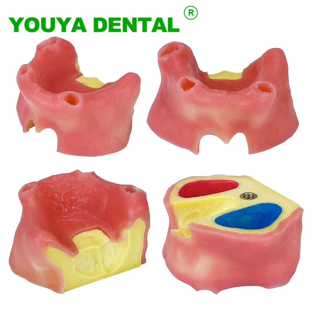 Dental Implant Model Teeth Teaching Study Model Edentulous Maxillary Sinus With Soft Gums Dentist Student Practice Training Tool