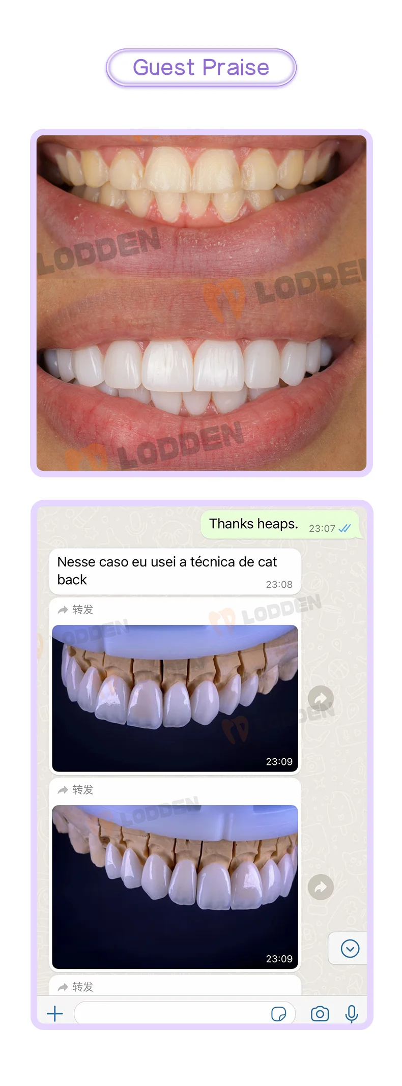 LODDEN 2 Box B40 Glaskeramikblöcke Dentallabor Lithiumdisilikat C14 für Zahnmedizin Veneers Kronen Sirona Cerec Frässystem – Detail 7
