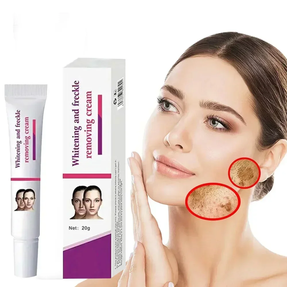 Spot Removal Cream Freckles Removal Lighten Melanin Fade Melasma Remove Facial Spots Dark Spot Remover