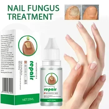 ⁿⁱᶜᵉ Fungal Nail Treatment Essence Oil Nail Fungus Repair Toenail Fingernail Treatment Onychomycosis with Mushrooms