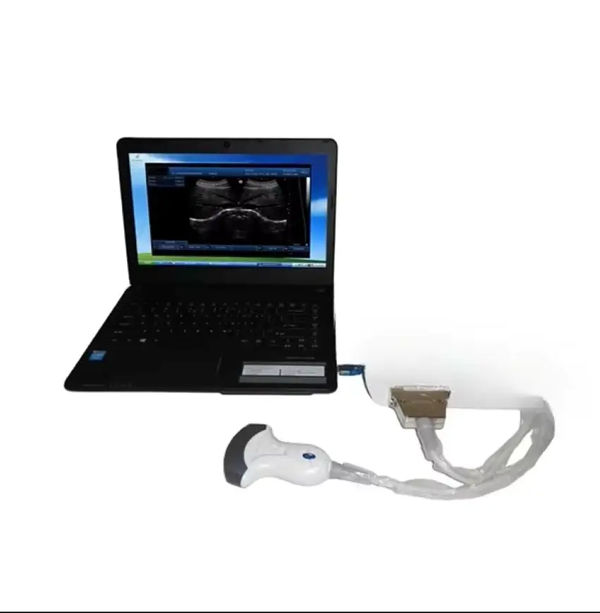 

Горячие продажиSY-A010 Человек или животное 3D черно-белое оборудование для глаз Ультразвуковой сканер Медицинский офтальмологический ультразвуковой аппарат B сканирования