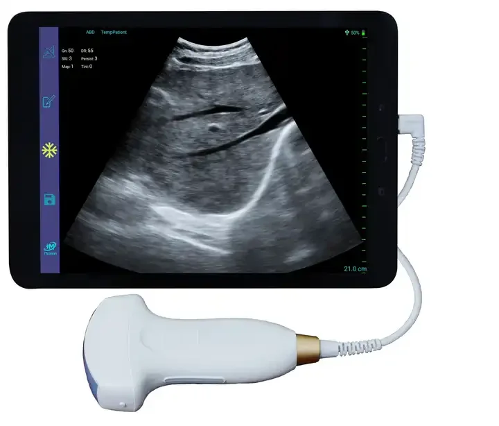 Sonde de scanner convexe linéaire USB intelligente médicale