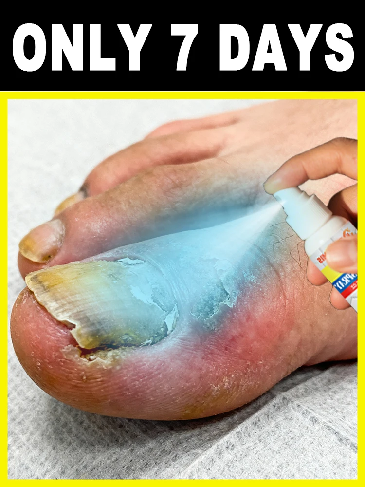 

Improve varicose veins and relieve leg ˢʷᵉˡˡⁱⁿᵍ ᵃⁿᵈ ᵈⁱˢᶜᵒᵐᶠᵒʳᵗ