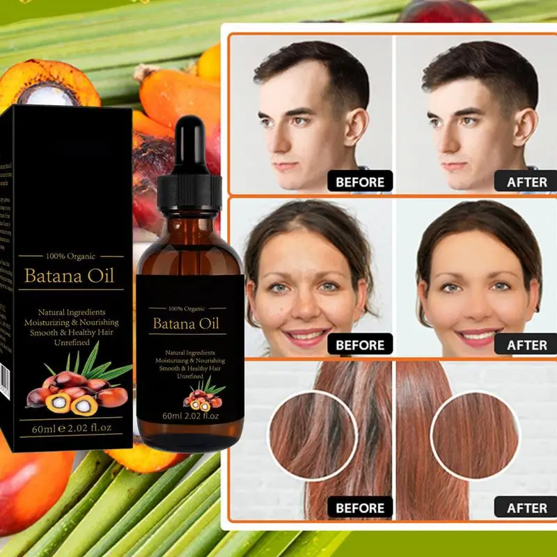 100% Organische Batana Olie Essence Wimper Groei Etherische Oliën Serum Haar Behandeling Wenkbrauw Snelle Groei Vloeistof