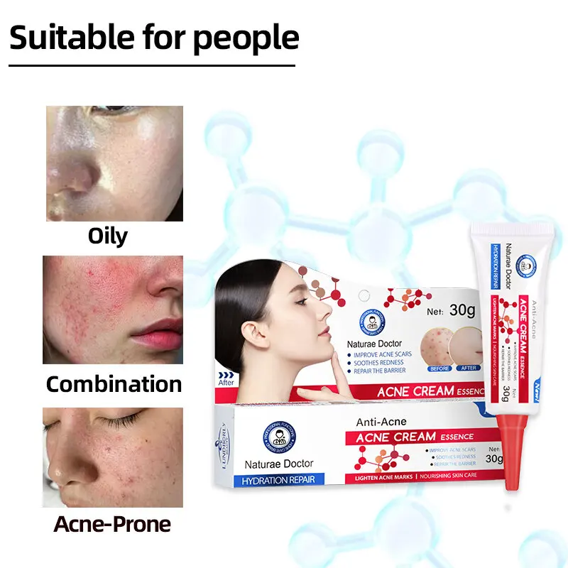 

Natural Herbal Acne Cream - Fades Acne Scars, Soothes Redness, Repairs Skin Barrier & Brightens Dullness, For All Skin Types