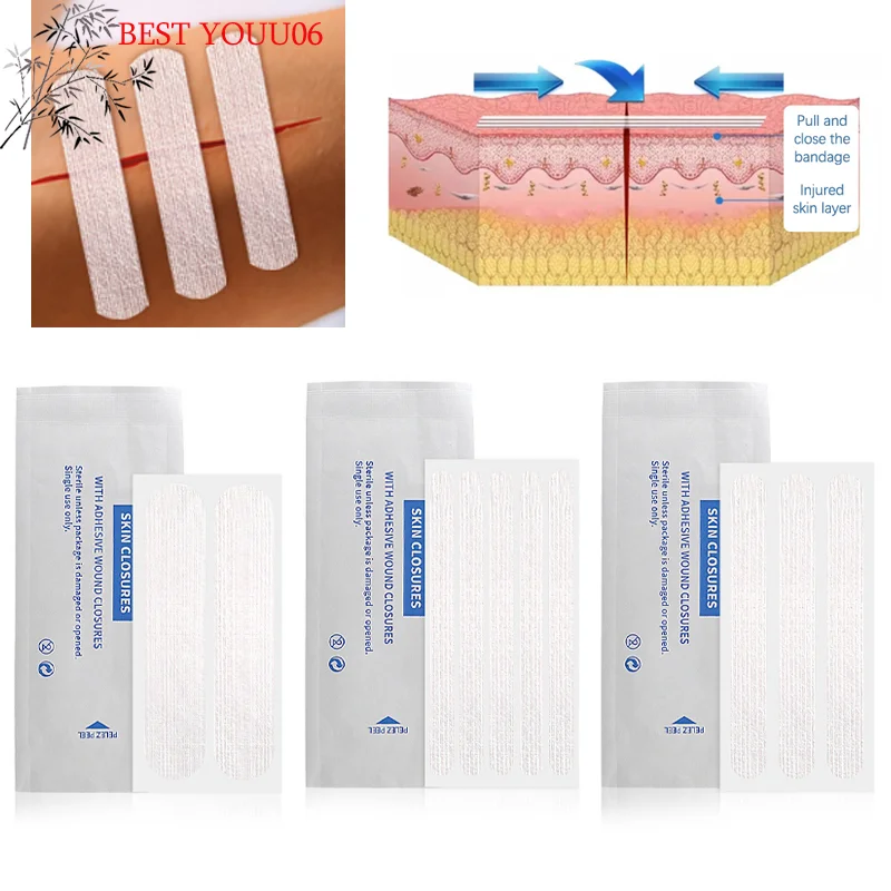 

(YOUU06)Outdoor 2/3/5 Strip Band-Aid Zipper Tie Wound Closure Patch Hemostatic Patch Wound Fast Suture Zipper Band-Aid