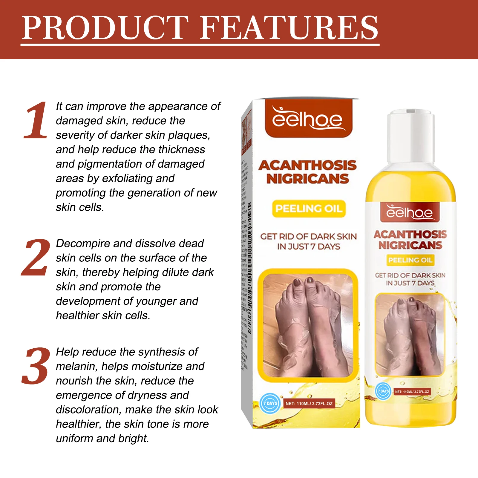 زيت تقشير EELHOE لتبييض البشرة الداكنة وإزالة مقشر الجلد الميت والذراع والكوع والركبة والساق زيت تقشير Nigricans 110 مللي