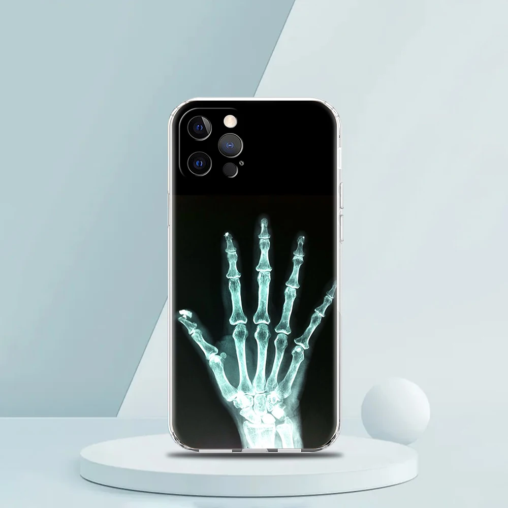 غطاء هاتف شفاف لهاتف iPhone 16,15,14,13,12,11,Pro,Max,8,7,Plus,16E,XS,Max Soft TPU Shell Autumu X Ray حقيبة عظام اليد