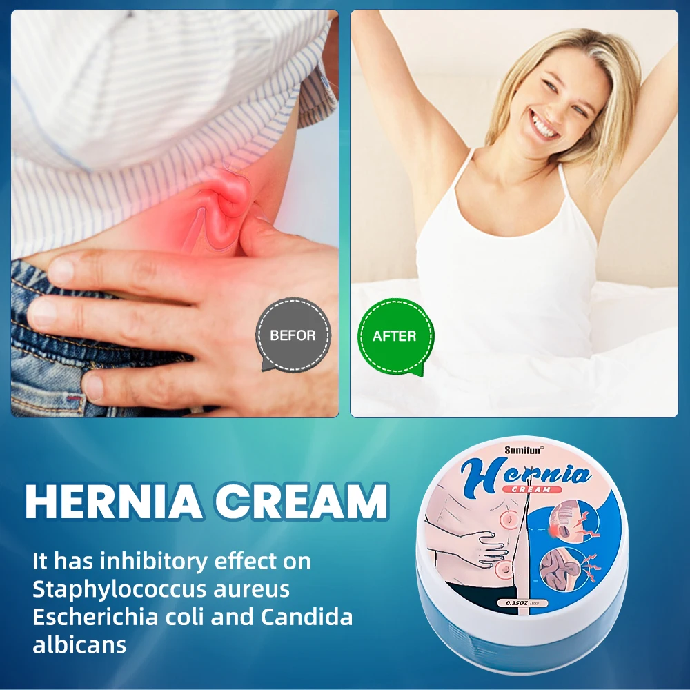 10g Sumifun Inguinal Hernia Treatment Cream Back Umbilical Hernia Remover Ointment Abdominal Wall Colic Relief Herbal Medicine