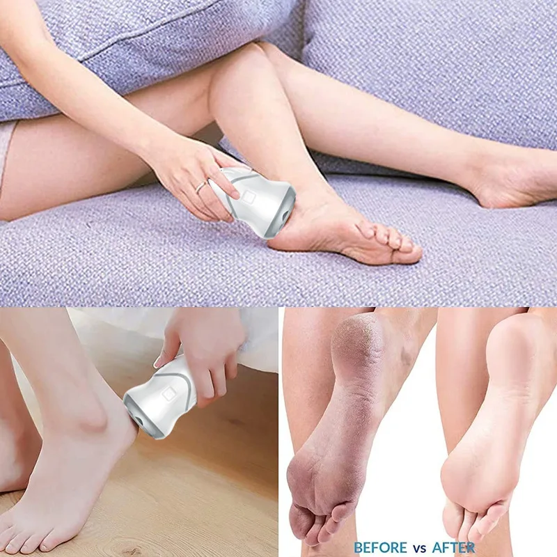 Portable Battery Rechargeable Grinder Electric Foot File Hard Skin Remover Pedicure Electronic Foot File