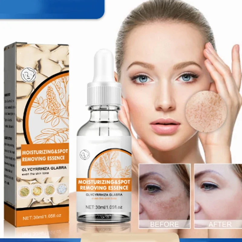 Whitening&lightening Spot Essence To Lighten Chloasma Replenish Water Moisturize Brighten and Beautify Skin whitening serum