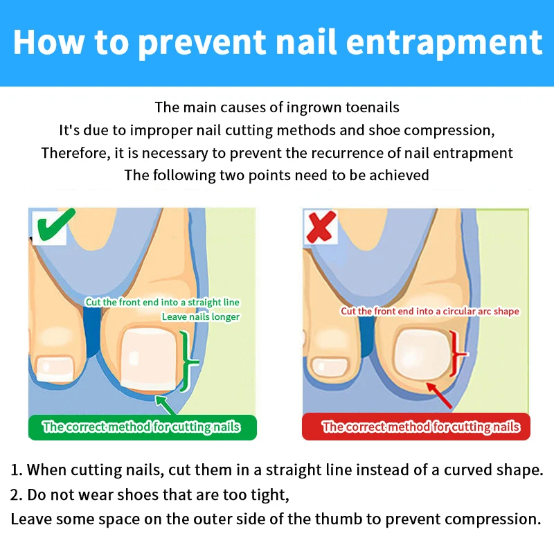 10PCS Trattamento delle unghie dei piedi incarnite Strumento di correzione dell'unghia del piede incarnita Adesivo patch elastico Raddrizzamento Clip Brace Strumenti per pedicure