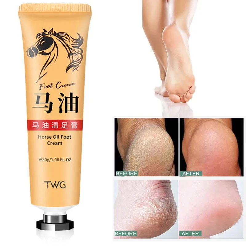 

Крем для ног против трещин, восстанавливающий крем для пяток, потрескавшейся лошадиным маслом, гладкое удаление омертвевшей кожи, мозолей, против высыхания, уход за кожей рук, ног, 30 г