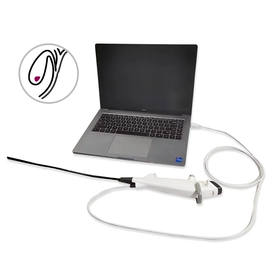 Single Use Flexible Choledochoscope High-Definition Imaging Tool for Gallstone Related Checking Tasks