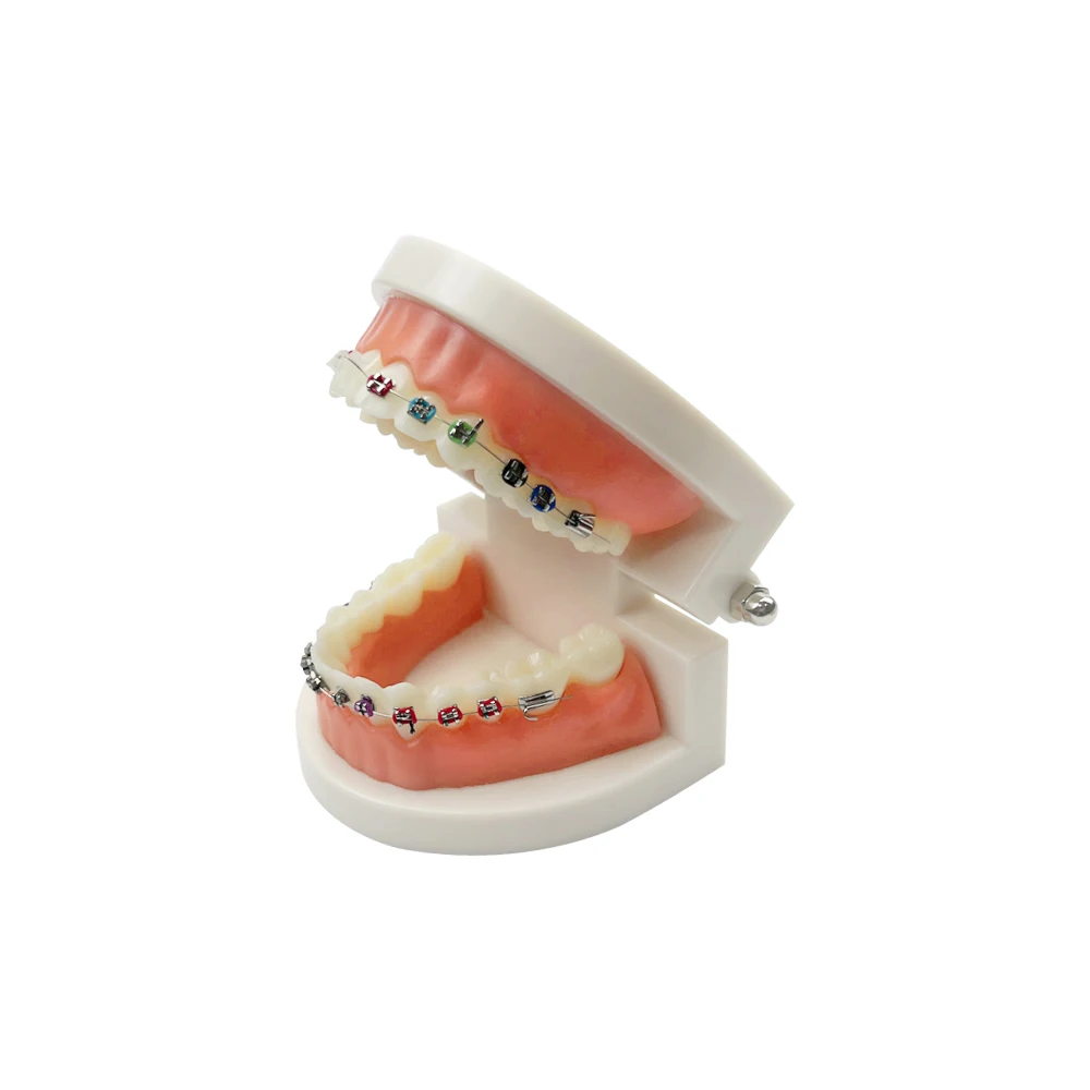 

Dental Teaching Model Adult Standard Orthodontic With Braces Metal Ceramic Brackets Dentistry Studying Education Model
