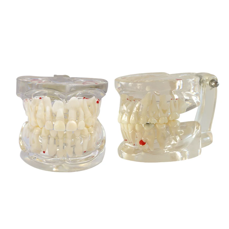 

Dental Teeth Model Half Pathology Model Dental Model Teeth Teaching Model Study Dental Materials