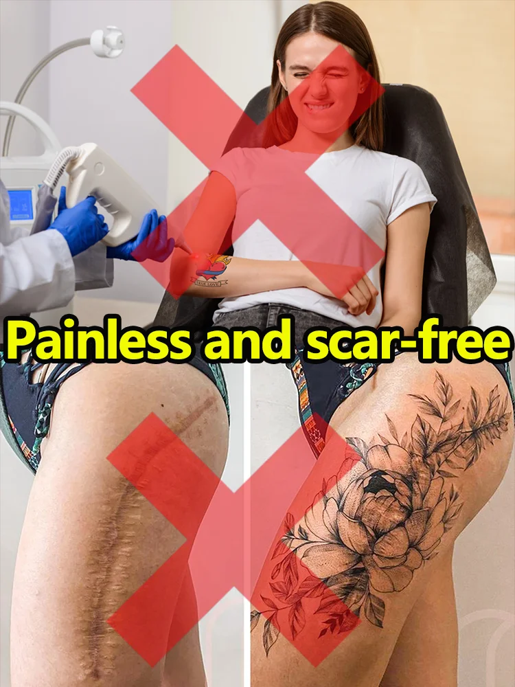 Various sizes of tattoo patterns and shapes disappear