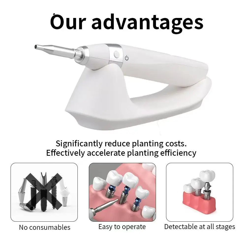 Stability Osseointegration Meter Resonance Frequency