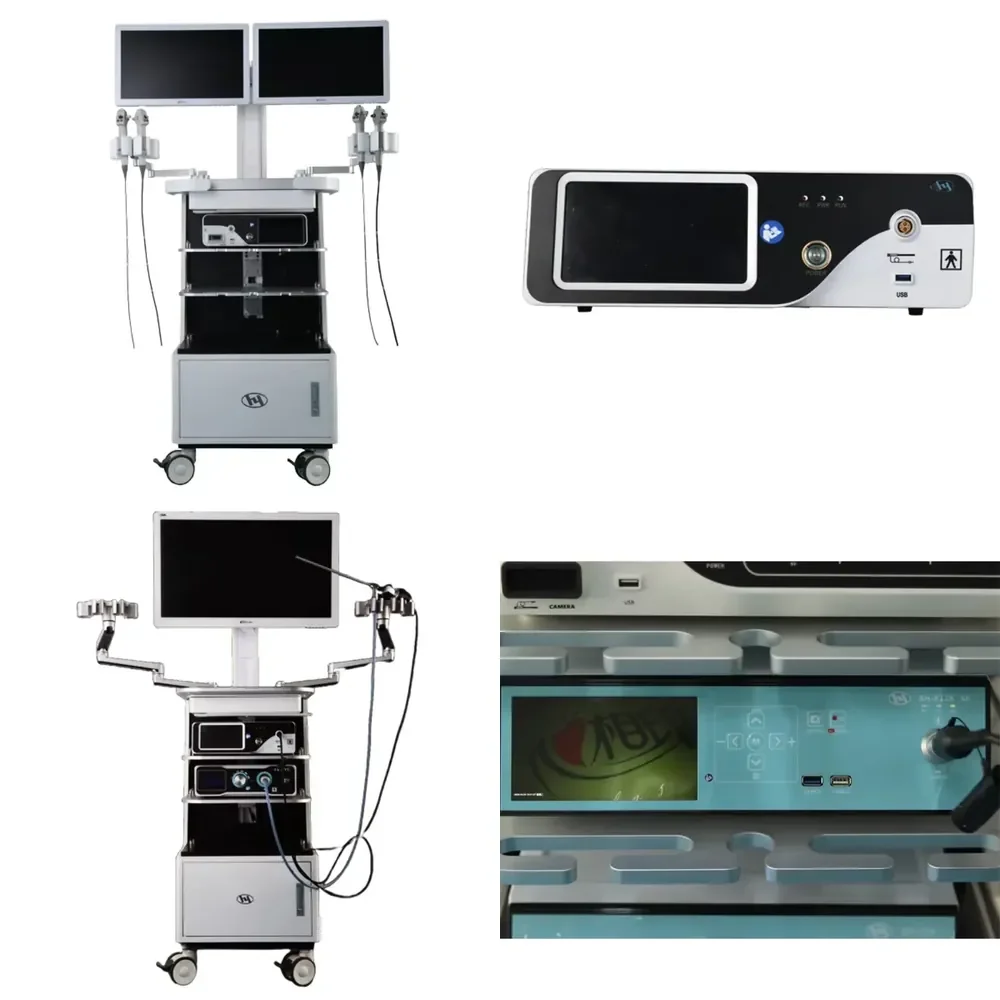ENT Video Endoscopy System With Cold Light Source for Clinic Hospital Use