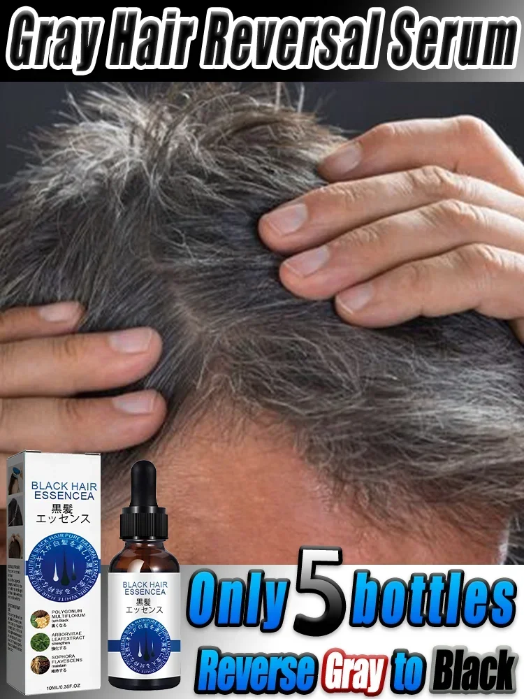 White hair killer, remove gray hair and restore natural hair color in 7 days