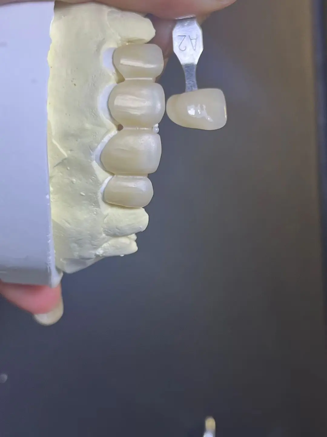 SHT Multilayer Zirconia Block Super High Translucent Crown Layer Long Bridge Material Vita 16 BL1-4 for CAD/CAM System