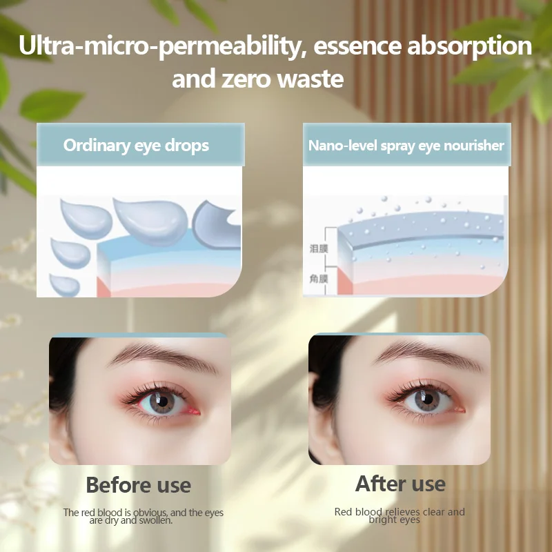 Afneembare waterdichte oogmistsproeier, draagbare USB oplaadbare verstuiver voor schoonheidsverzorging en reizen Stil oogcrèmeapparaat