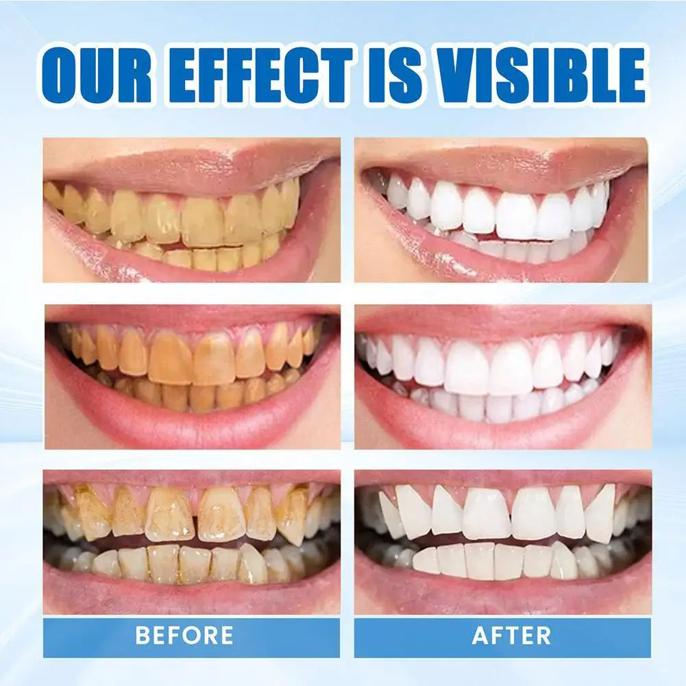 Fruit Whitening Toothpaste Adults Kids Oral Hygiene Cleaning Remove Plaque Stains Yellow Tooth Fresh Breath Dental Health Care