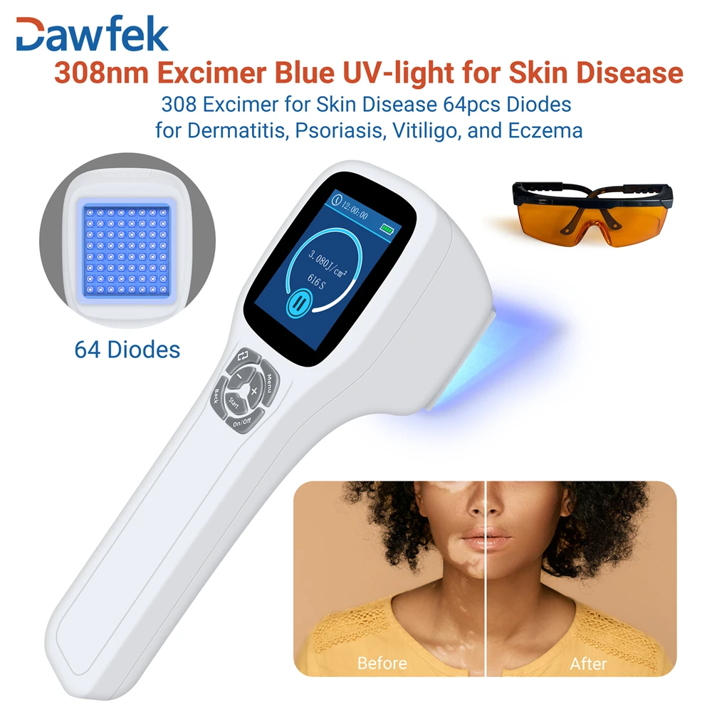 Dawfek 308nm UVB Phototherapy Device for Vitiligo Psoriasis Excimer Light Therapy Customizable Treatment for Skin Problems