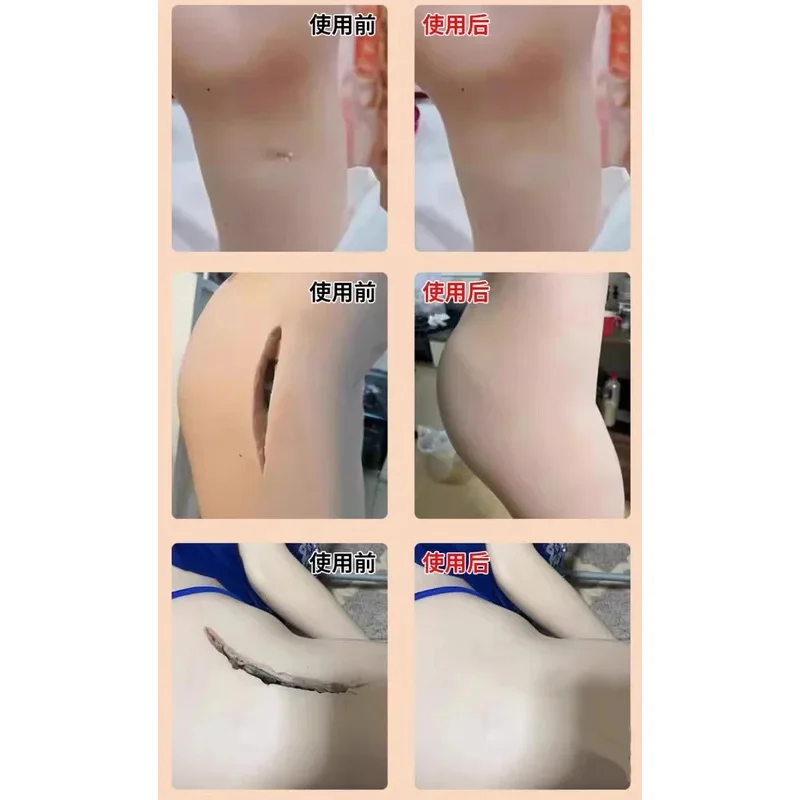 シリコン人形接着剤修理、シリコン製品、シリコン玩具修理剤、充填、接着、ひび割れ補修、柔らかい