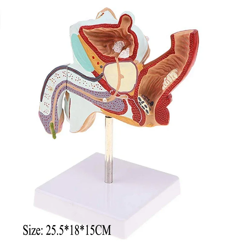 Male Internal Reproductive Pathology Model Male Reproductive Disease Anatomical Model Male Urinary System Disease Model