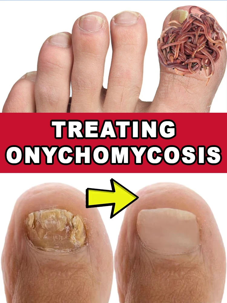 

Real case witness, let nails be reborn