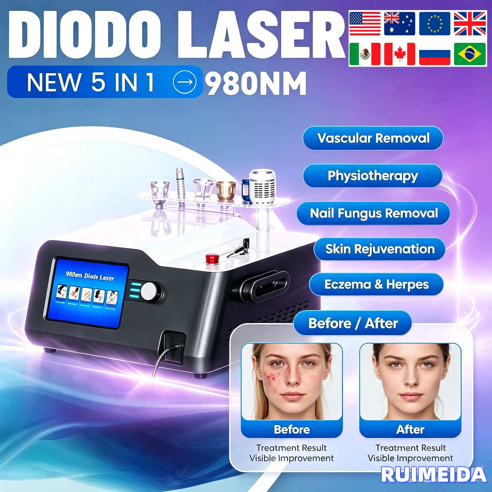 30W 5 in 1 980nm Diode Lase Vascular Removal Machine Nail Fungus Remove Eczema Herpes 980 Diode Lase Blood Vessels Removal