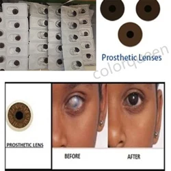 3pairs Iris Lenses aesthetic lenses Prosthetic Contact Lenses for People with Eye Defects glaucoma eye