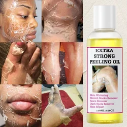 Yellow Peeling Oil Exfoliating Bleaching Dark Skin Spots Knee Finger Remove Dead Skin Melanin Whitening Brighten Body Skin Care