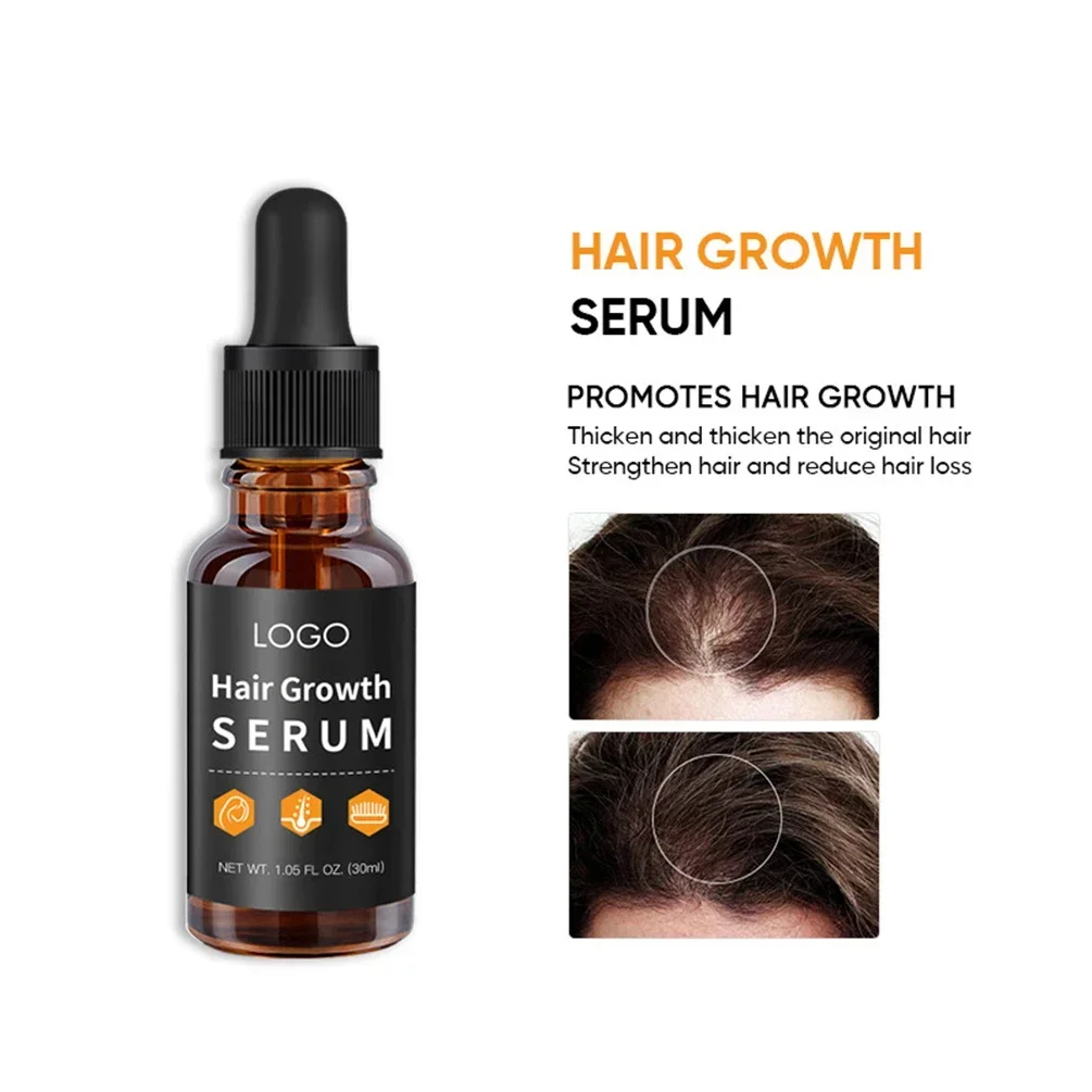 

30ml Private Label Hair Growth Serum Custom Logo Hairs Root Grow Nutrient Solution Prevention Hair-loss Essential Oil Makeup