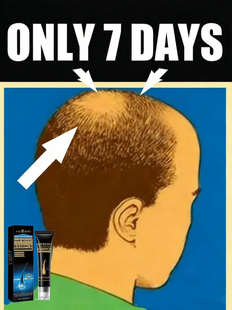 

99% Repurchase, More and More Hair, Say Goodbye to Baldness, Hot Selling Product