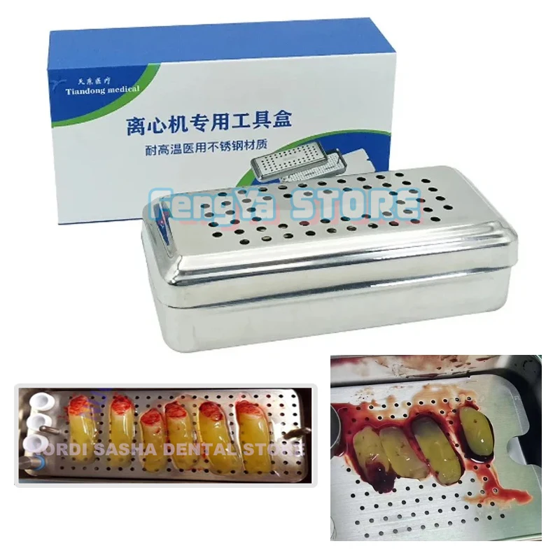 1 Set de Caja Dental PRF/GRF de Acero Inoxidable para Implantes, Caja de Fibrina Rica, Caja PRF Odontología, Implante Dental, Caja PRF Dental