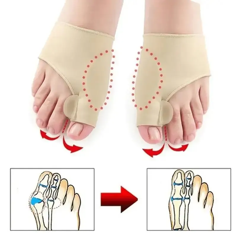 1 Pair Super Elastic Bunion Sleeve Bunion Corrector Protector PreventHallux Valgus - Foot Caring Toe Corrector Health Care