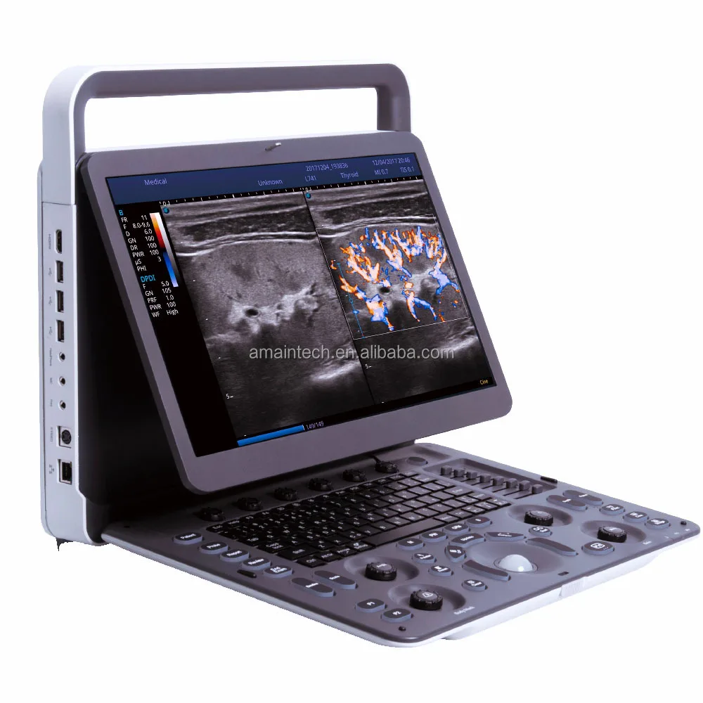 Sonoscape E2 Fabrieksprijs Laptopscanner Ultrasone diagnostische apparatuur Machine Draagbaar