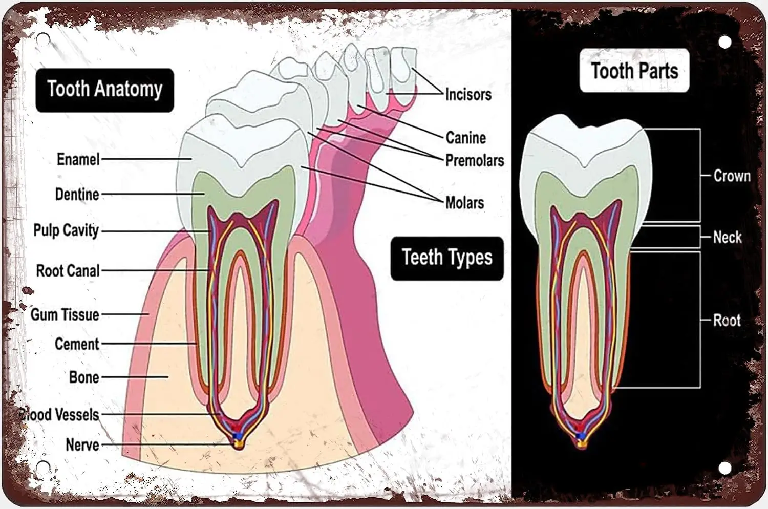 Dental Knowledge Metal Tin Sign Tooth Anatomy Posters Metal Signs Dentist Encyclopedia Iron Plaques Office Hospital Consultation