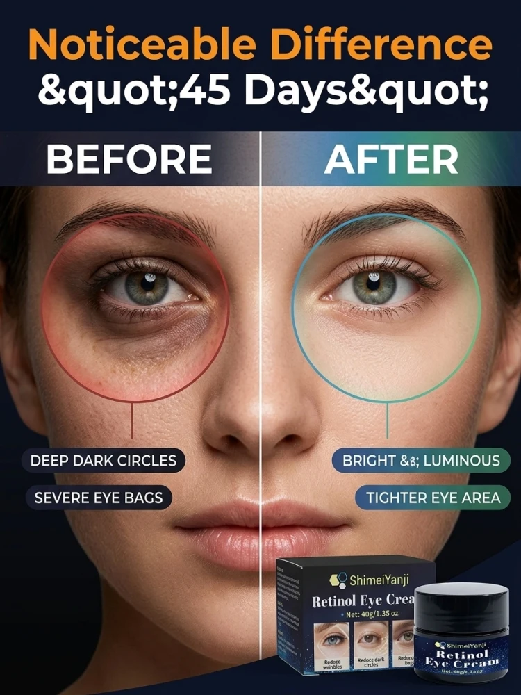 Retinol Eye Cream, Moisturizing Eye Area Skin Care Cream, Nourish & Smooth Fine Texture, Improve Eye Skin Appearance for Daily Facial Care