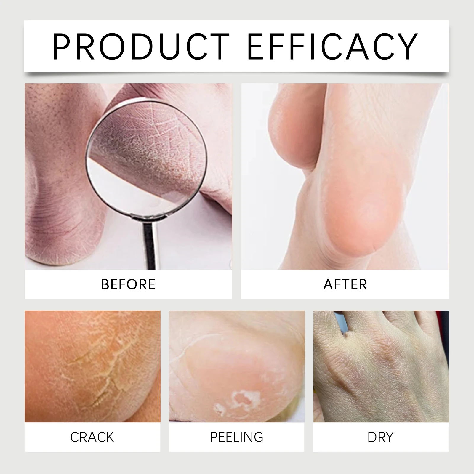 40% Urea Hand&Foot Moisturizing Stick,Twist Up Balm&Clean Application,Softens Hard Skin&Dead Skin Precisely,Solid Texture For Targeted Care,Deeply Repairs Cracked Skin&Nourishes,Long Lasting Hydration,Rebuild Skin Barrier,Moisturize Anywhere.Multi Use