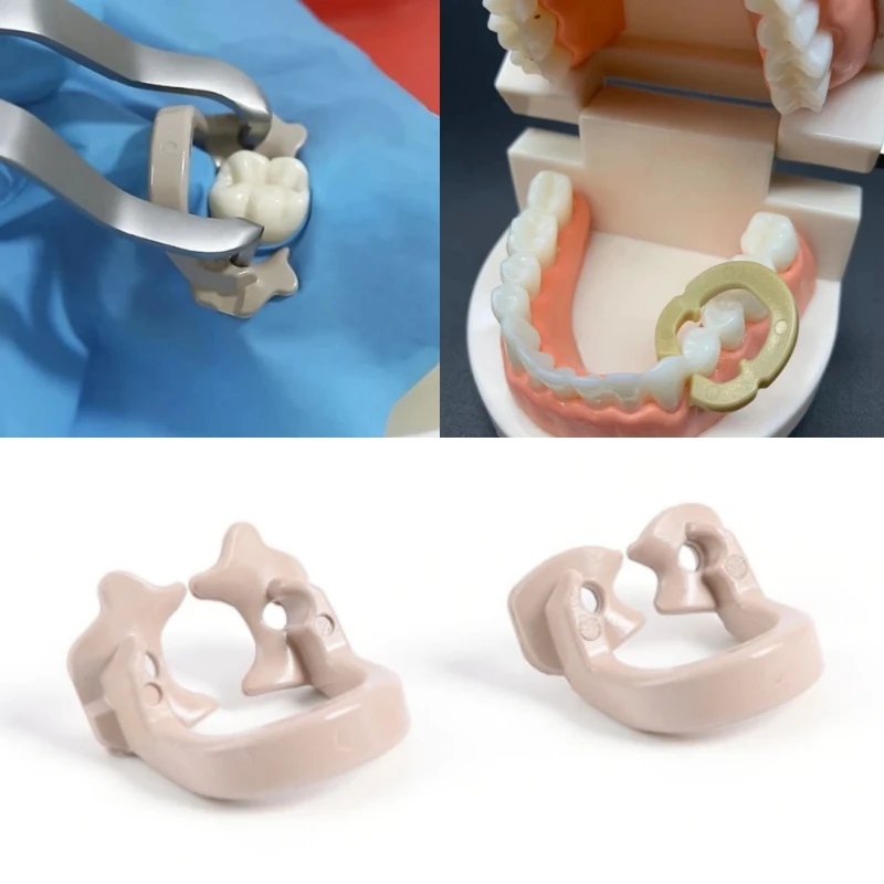 4Pcs/Box Dental Dam Rubber Clamps Resin Barrier Clip Separator Ring Sectional Matrix Band Fixed Clamp Dentistry Material