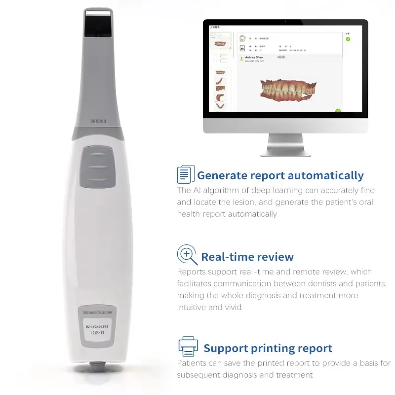ماسح ضوئي ثلاثي الأبعاد للأسنان داخل الفم + برنامج CAD CMD ترميم تقويم الأسنان CE ISO المعتمد عن طريق الفم ثلاثي الأبعاد ماسح ضوئي داخل الفم Runyes 3.0 #3