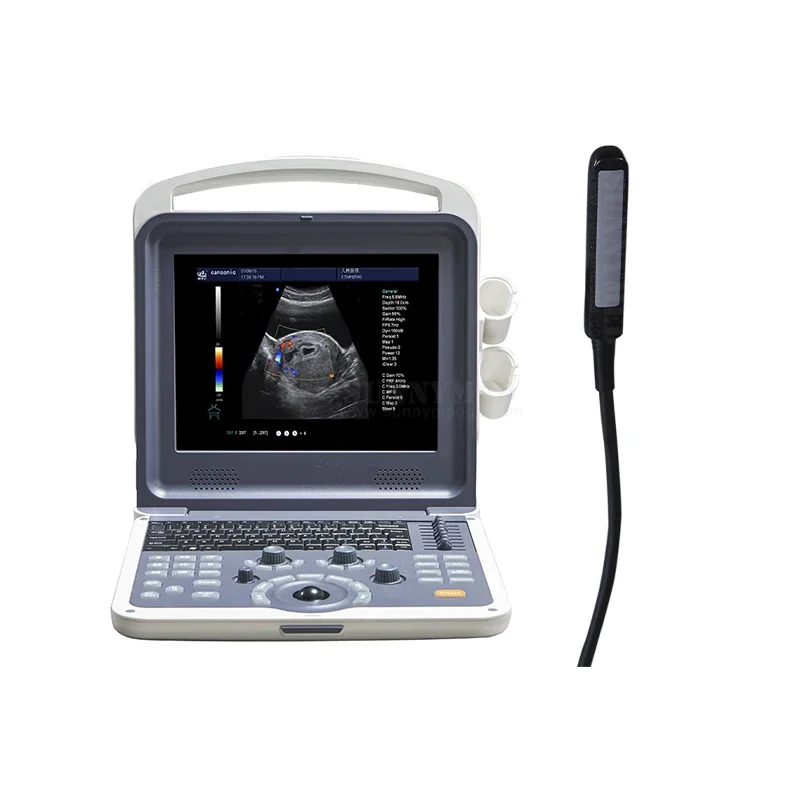 SY-A042N Portable obstetrics and gynecology ultrasound machine 4D