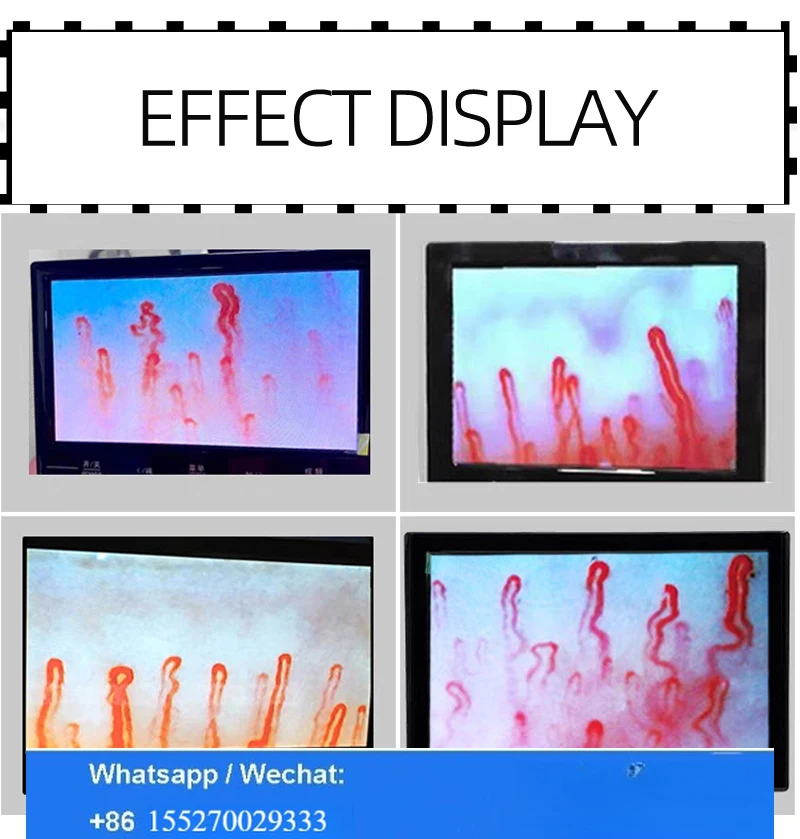 Portable Nail Wall Capillary Microcirculation Detector for Vessel Analysis with 7 8 9 10.1 Inch LCD Display for Medical