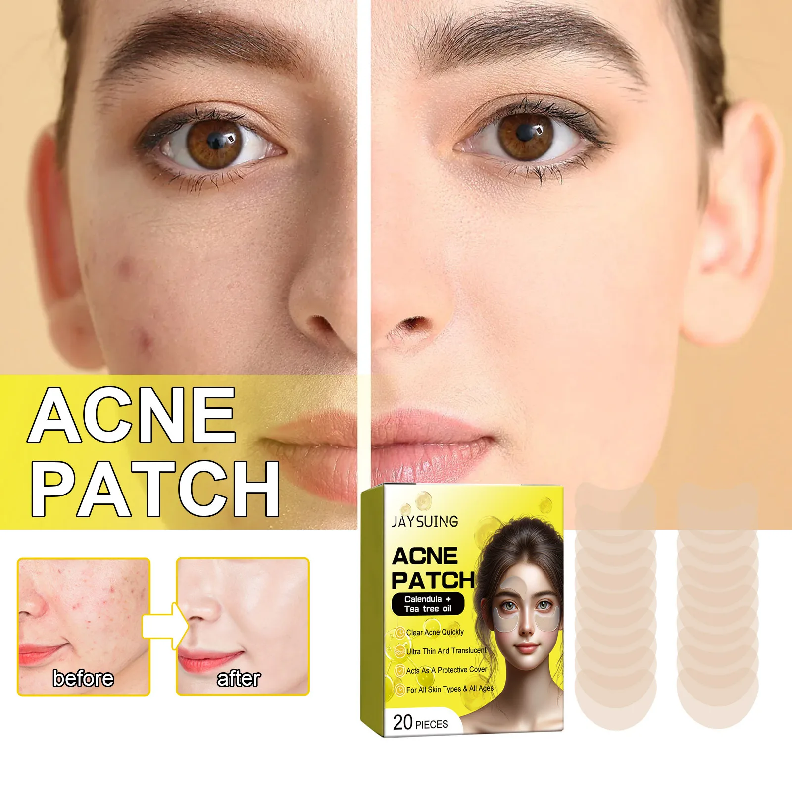 Cleansing Facial Acne Acne Closing Blackhead Removal Delicate Skin Acne Patch