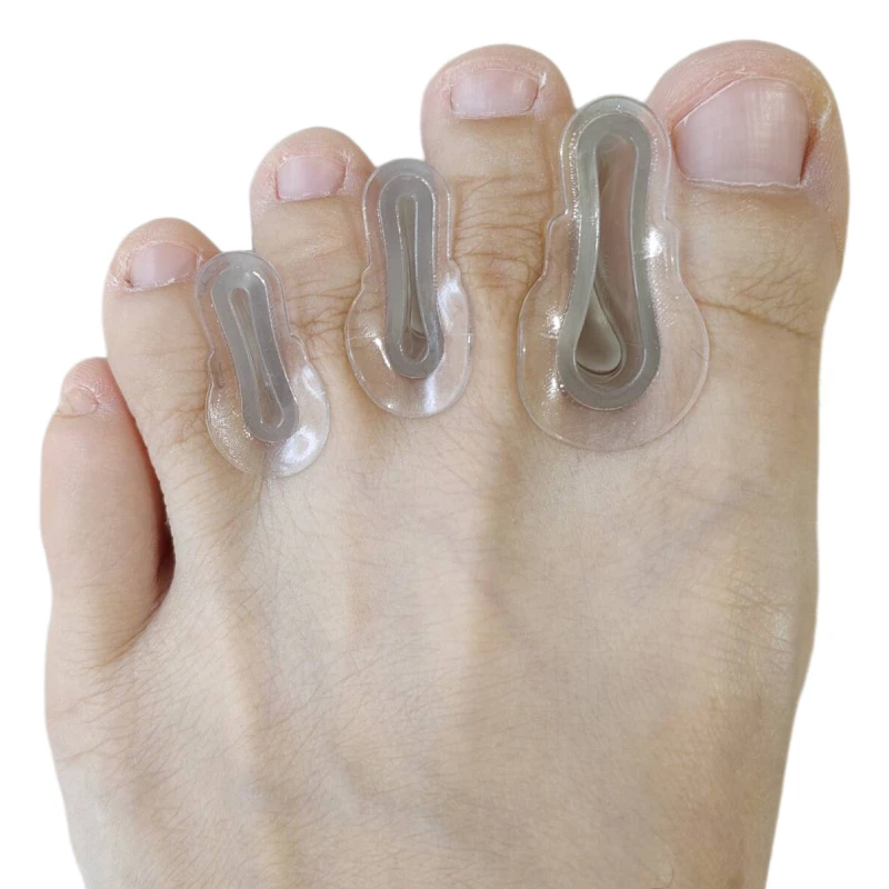 

20pieces=10pairs Thumb Overlap Separator Hallux Valgus Toe Orthosis Clip Silicone Gel Feet Care Splitter Bunion Corrector