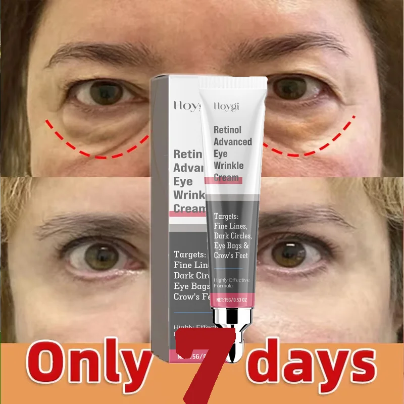 Retinol Anti-wrinkle Eye Cream Instant Remove Eye Bags Fade Fine Lines Anti Dark Circle Puffiness Moisturizing Brighten Eye Care