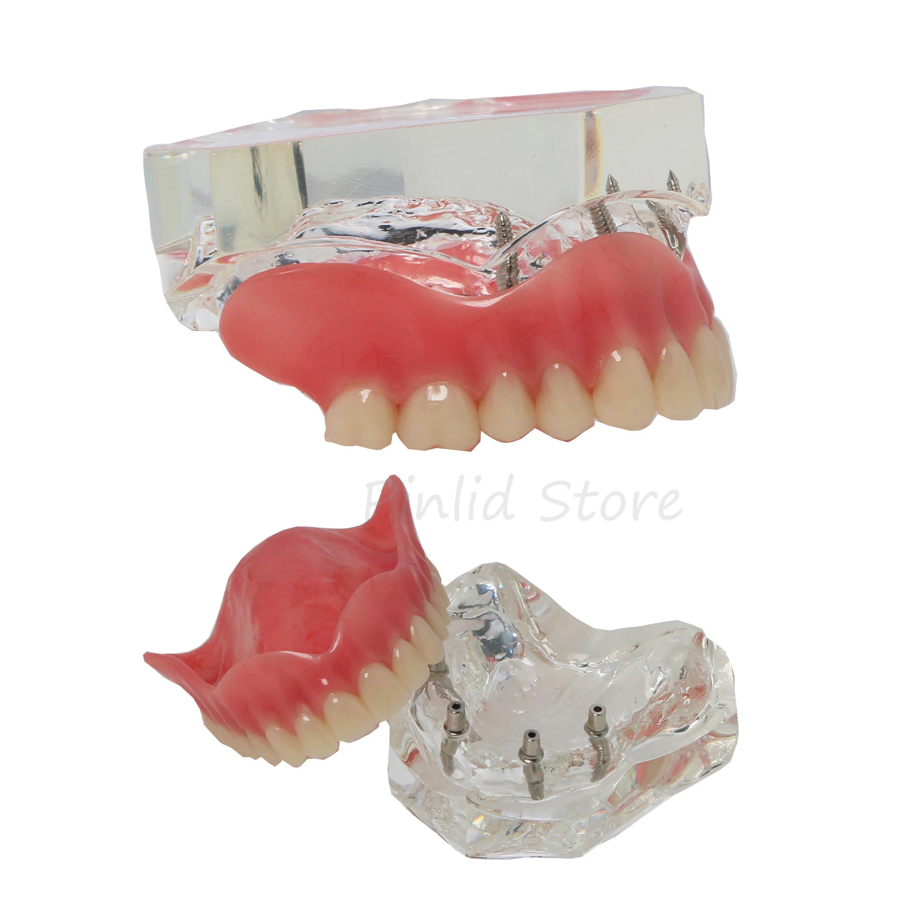 

Dental Models Teaching Practice Training Removable Dental Practice Display Models Presentation Tools